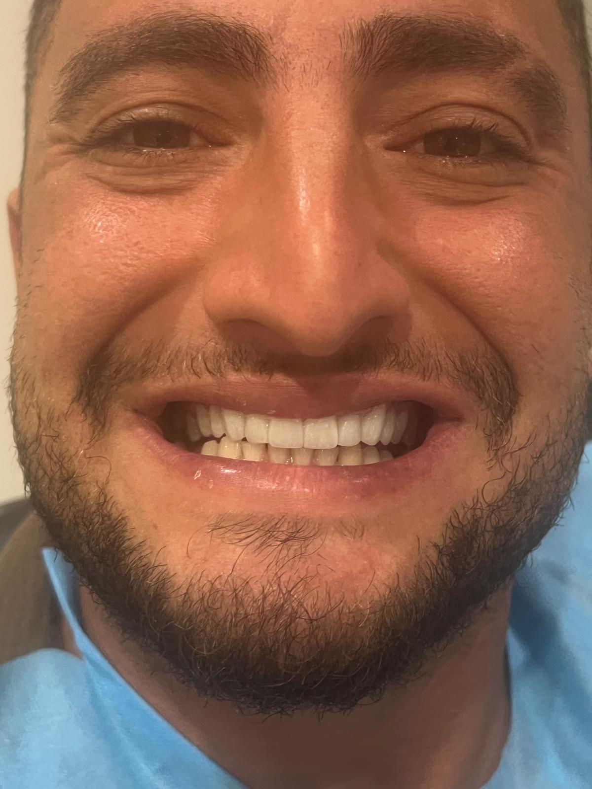 ECE Dental Patient Transformation